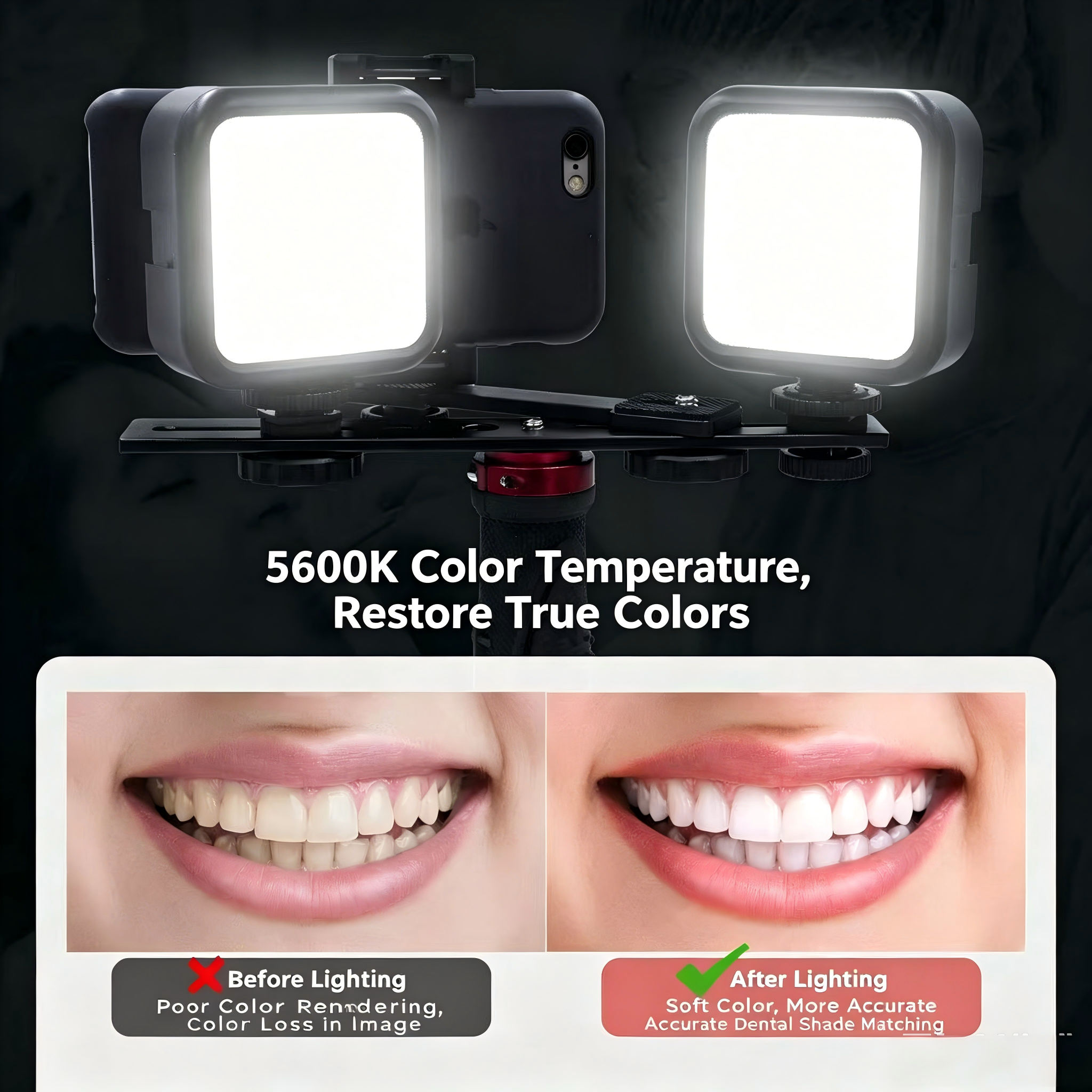 Portable Dental Photography Li - مراجعة Photography Lighting Definition وسعره